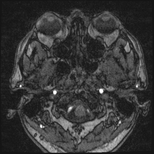 Click on the Serie image to view the images of VILLANUEVA, WILLIAM A.